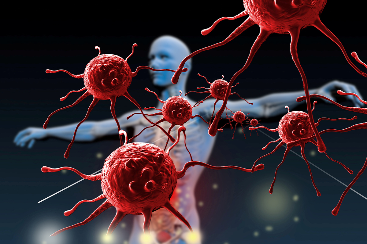 Overactive Immune System Symptoms You Should Not Ignore